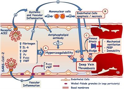 Pathophysiological Processes Underlying the High Prevalence of Deep Vein Thrombosis in Critically Ill COVID-19 Patients
